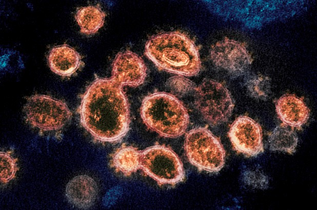 قد يكون لدى ولاية كاليفورنيا سلالة كوفيد-19 شديدة العدوى في 25 يناير!