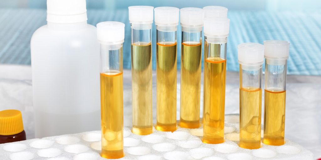 اعراض سرطان المثانة عند النساء