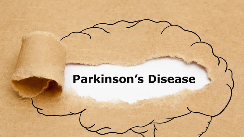 ما هو مرض باركنسون؟! التفاصيل كاملة